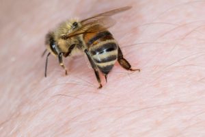 Home remedies for treating yellow jacket sting