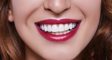 Reason why you should get your teeth whitened