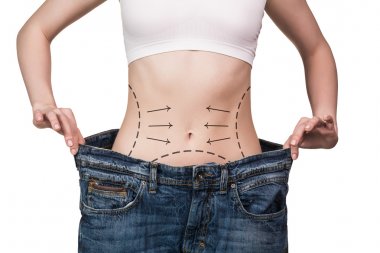 Side Effects of Weight Loss Surgery and How to Combat them 