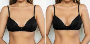 Does Breast Actives really work?