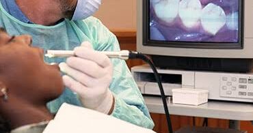 Intraoral Dental Cameras