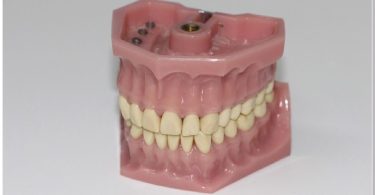 Ways to relieve denture pain