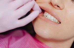 Common Causes Of Poor Dental Health