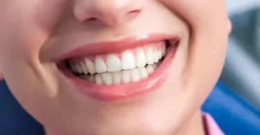 Dental Crown Lengthening Procedure